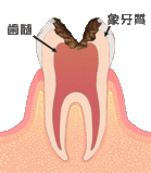 0167011004_コピー