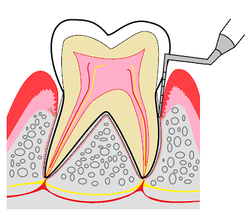 歯周検査 その1_コピー